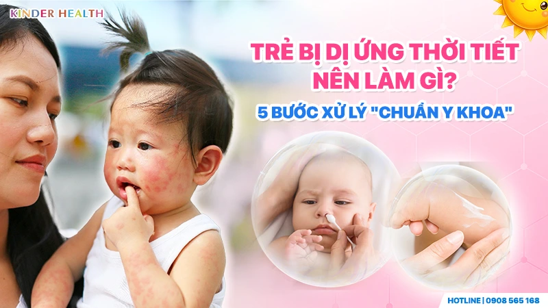 5 bước xử lý chuẩn y khoa cho trẻ bị dị ứng thời tiết 