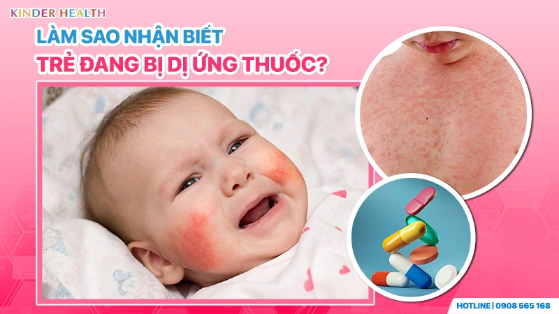 Trẻ sơ sinh bị nổi ban đỏ ở mặt và ngực - Dấu hiệu nhận biết dị ứng thuốc sớm