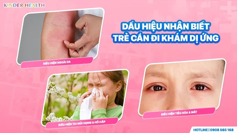 Dấu hiệu nhận biết trẻ cần đi khám dị ứng
