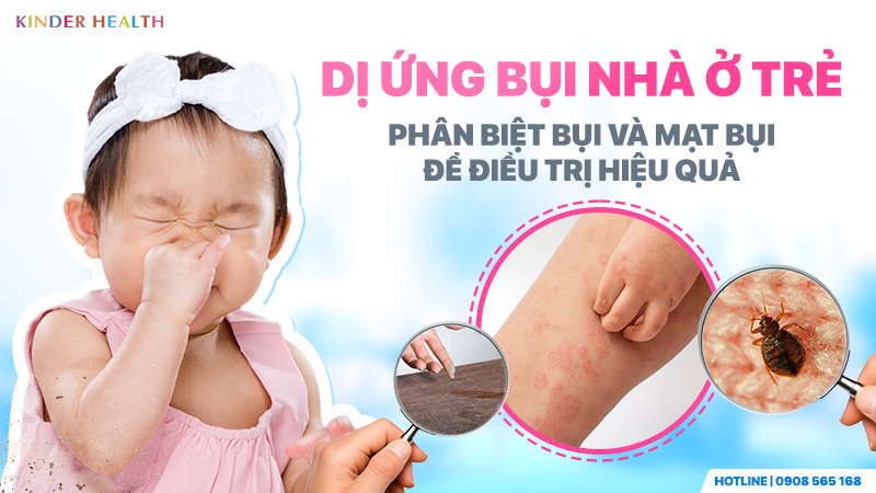 Dị ứng bụi nhà ở trẻ