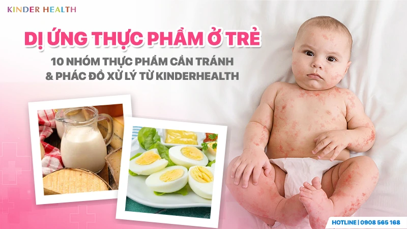 Dị ứng thực phẩm ở trẻ và phác đồ xử lý an toàn cho bé tại KinderHealth.