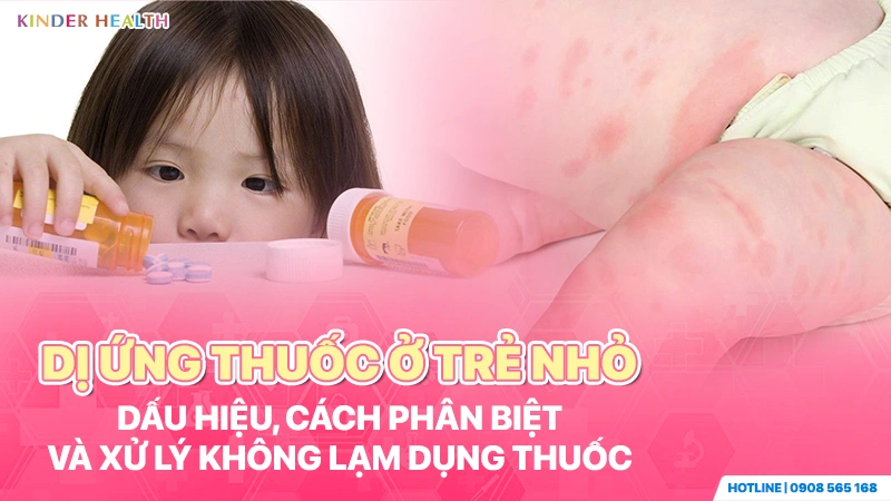 Dị ứng thuốc ở trẻ nhỏ: Hình ảnh bé bị phát ban vùng da đùi và các loại thuốc cần lưu ý