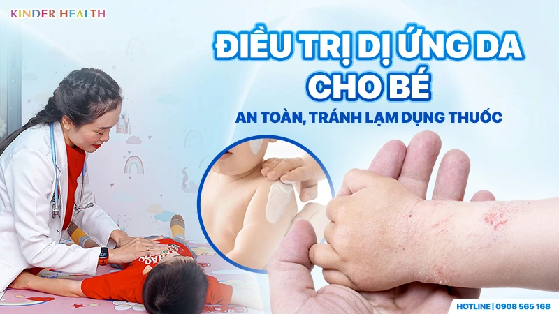 Điều trị dị ứng da cho bé an toàn, tránh lạm dụng thuốc với hướng dẫn từ bác sĩ KinderHealth