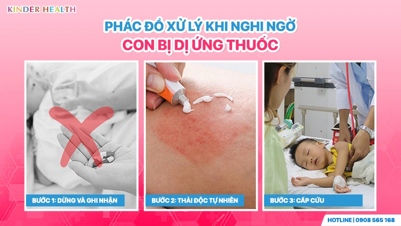 3 bước sơ cứu khi trẻ bị dị ứng thuốc: Dừng thuốc, thải độc da và đưa đi cấp cứu