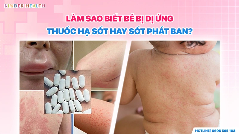 So sánh hình ảnh bé bị sưng môi (dị ứng thuốc) và bé bị nổi ban đỏ ở lưng (sốt phát ban) để phân biệt bệnh