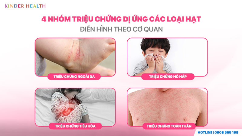 4 Nhóm triệu chứng dị ứng các loại hạt điển hình theo cơ quan