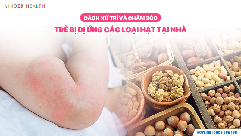 Cách xử trí và Chăm sóc trẻ bị dị ứng các loại hạt tại nhà