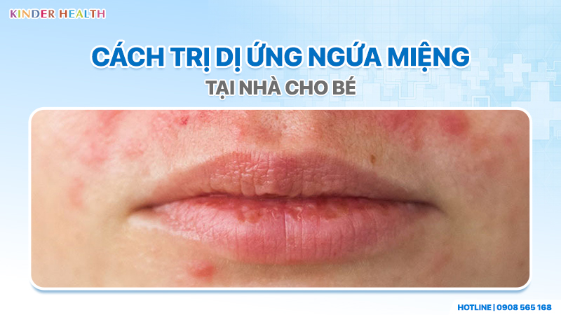 Cách trị dị ứng ngứa miệng tại nhà cho bé