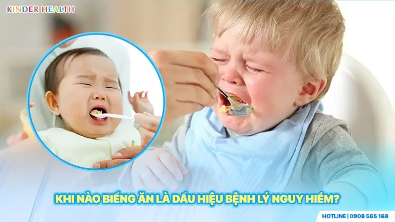 Biếng ăn bệnh lý thường kéo dài trên 2-4 tuần