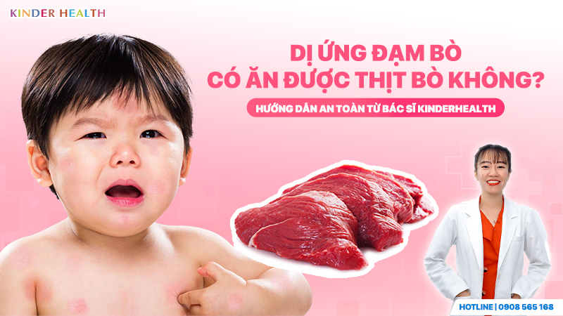 Dị ứng đạm bò có ăn được thịt bò không