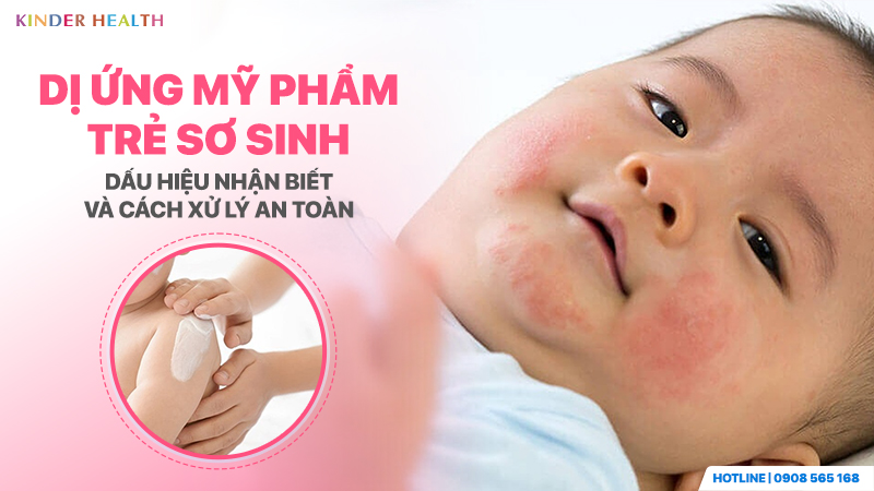 Dị ứng mỹ phẩm trẻ sơ sinh
