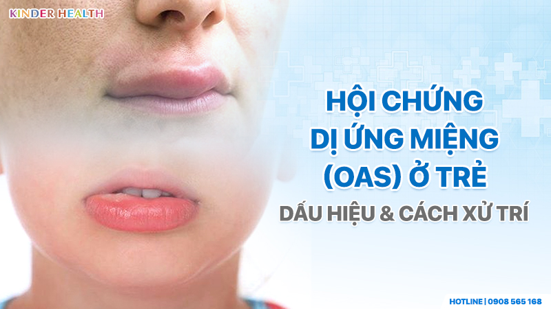 Hội chứng dị ứng miệng ở trẻ