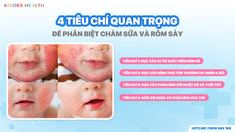 4 Tiêu chí quan trọng để phân biệt Chàm sữa và Rôm sảy