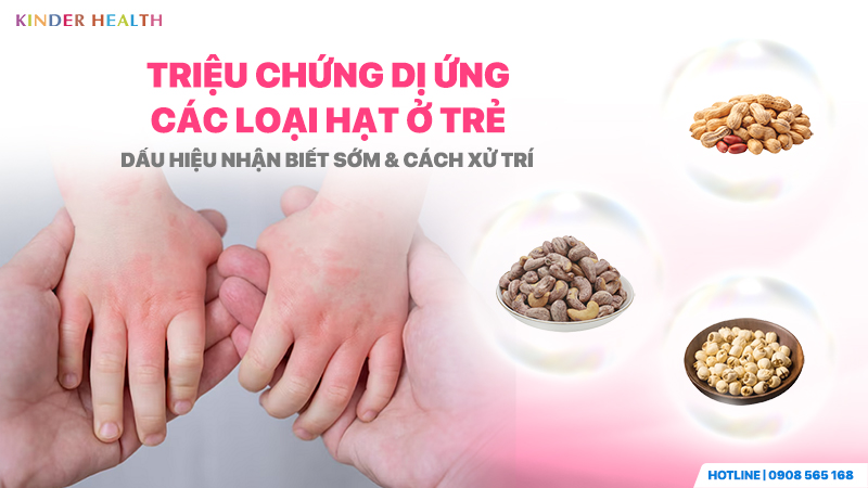 Triệu chứng dị ứng các loại hạt ở trẻ: Dấu hiệu nhận biết sớm & Cách xử trí