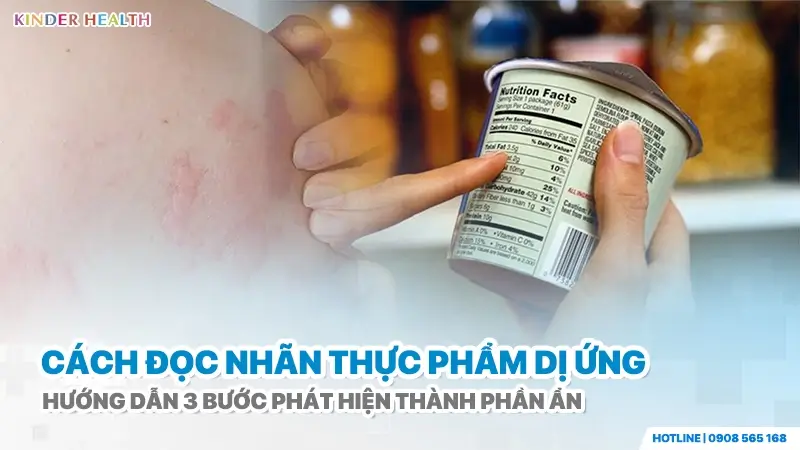 Xem kỹ bảng thành phần trên nhãn thực phẩm để phát hiện dị nguyên ẩn, ngừa mẩn đỏ dị ứng.
