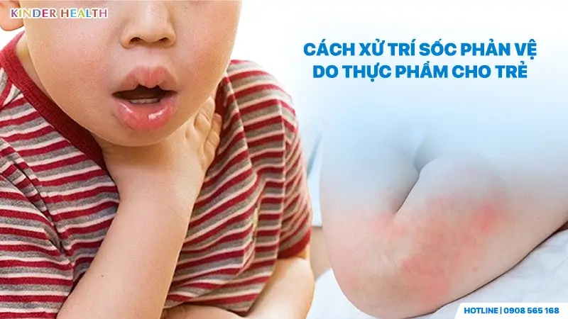 Hướng dẫn cách xử trí sốc phản vệ do thực phẩm khi trẻ có biểu hiện khó thở và nổi mề đay.