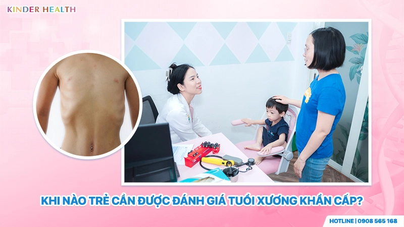 bác sĩ KinderHealth tư vấn và giúp gia đình giải đáp thắc mắc khi nào trẻ cần được đánh giá tuổi xương khẩn cấp để kịp thời can thiệp đà tăng trưởng