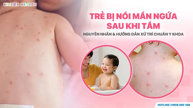 Lưng trẻ sơ sinh nổi nhiều nốt mẩn ngứa sưng đỏ sau khi được tắm rửa.