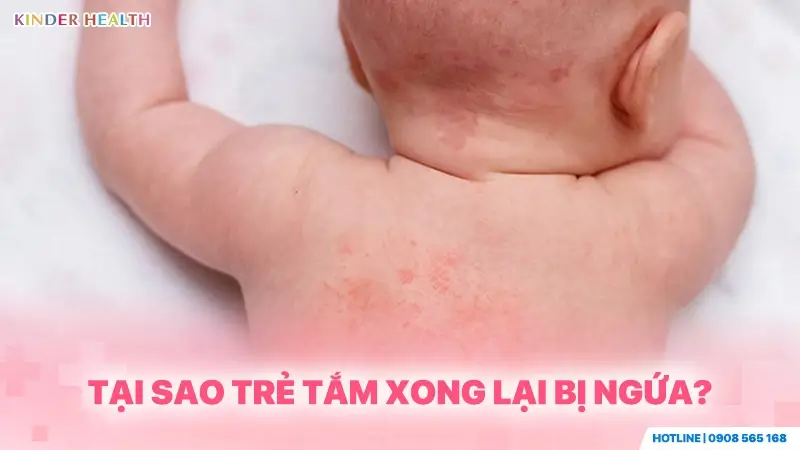 Lưng trẻ sơ sinh nổi các mảng sẩn đỏ giúp giải đáp thắc mắc tại sao trẻ tắm xong lại bị ngứa