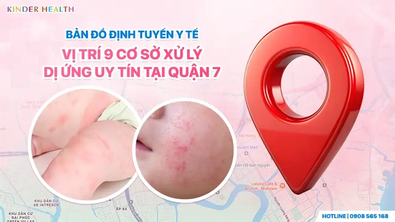 Bản đồ định tuyến các cơ sở y tế khám dị ứng uy tín tại quận 7