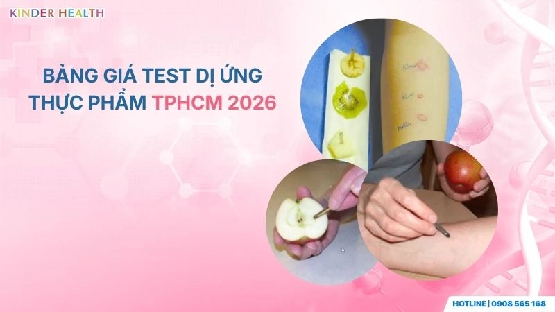 Bảng Giá Test Dị Ứng Thực Phẩm TP.HCM: Chi Phí Xét Nghiệm Mới Nhất 2026