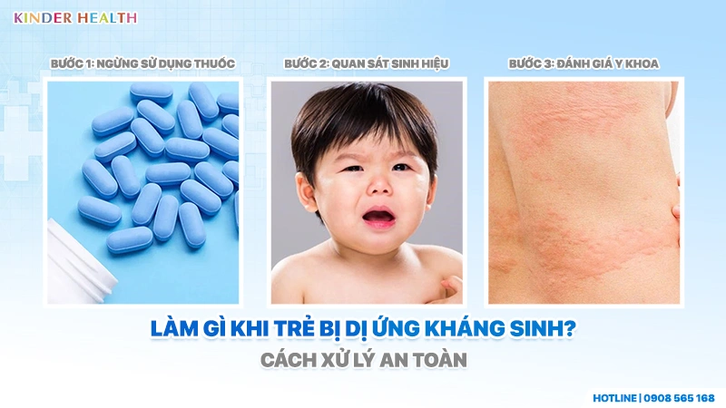 các bước xử lý an toàn khi trẻ bị dị ứng thuốc kháng sinh
