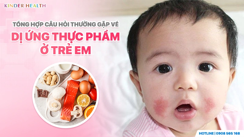 Tổng hợp câu hỏi thường gặp về dị ứng thực phẩm ở trẻ em