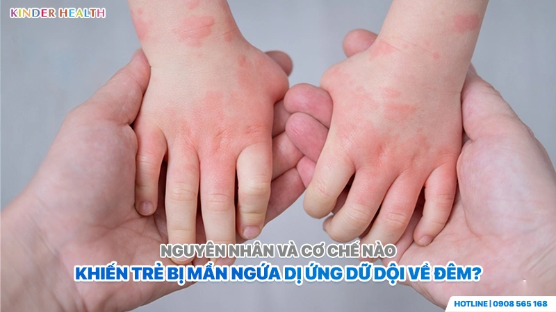 Cách Giảm Ngứa Dị Ứng Ở Trẻ: Cắt Đứt Vòng Luẩn Quẩn Ngứa - Gãi Không Dùng Thuốc 2 tìm hiểu nguyên nhân và cơ chế trẻ nổi mẩn ngứa dữ dội về đêm