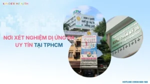 Top 5 Nơi xét nghiệm dị ứng da uy tín tại TPHCM