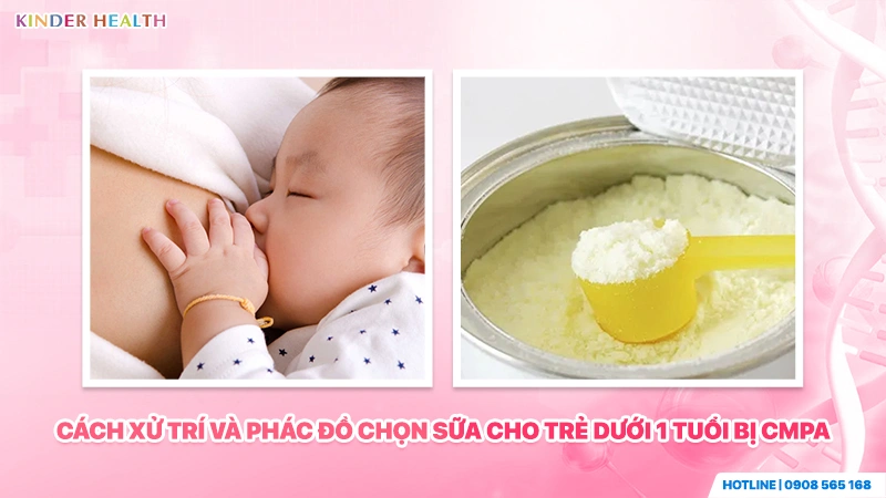 cách xử lý và phác đồ chọn sữa cho trẻ dưới 1 tuổi bị dị ứng đạm sữa bò cmpa