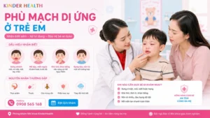 Phù Mạch Dị Ứng Ở Trẻ Em