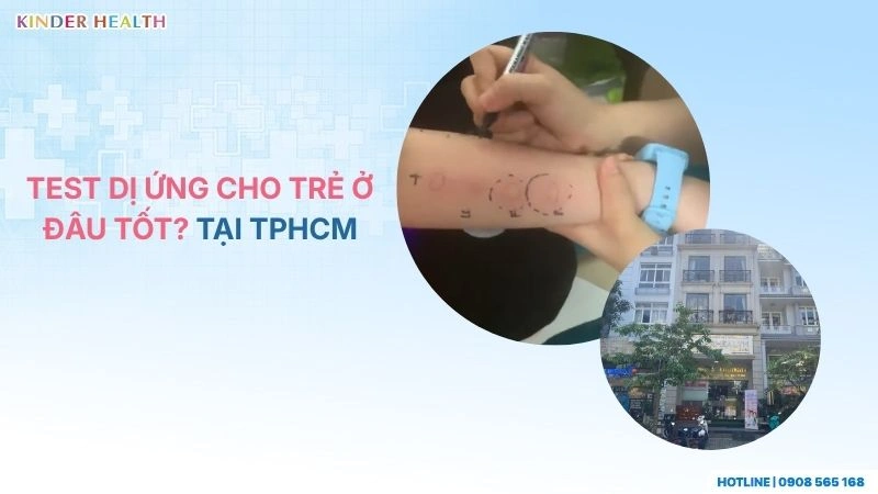 Test Dị Ứng Cho Trẻ Ở Đâu Tốt? Top 7 Địa Chỉ Uy Tín Tại TPHCM