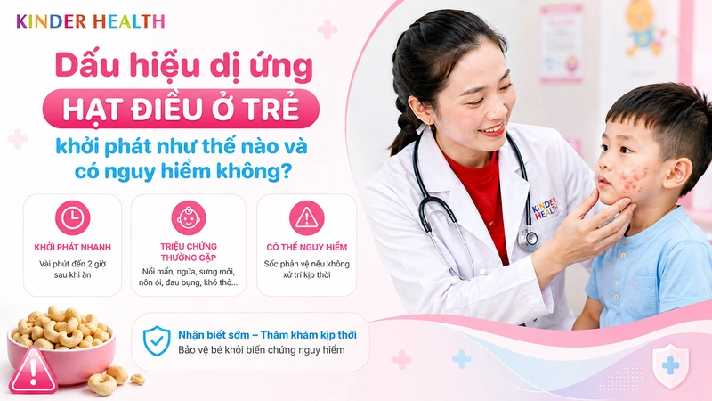 Dấu hiệu dị ứng hạt điều ở trẻ khởi phát như thế nào và có nguy hiểm không?