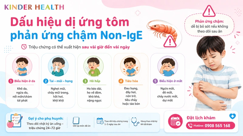 Dấu hiệu dị ứng tôm theo con đường phản ứng chậm Non IgE