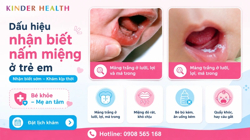 dấu hiệu nhận biết nấm miệng ở trẻ em