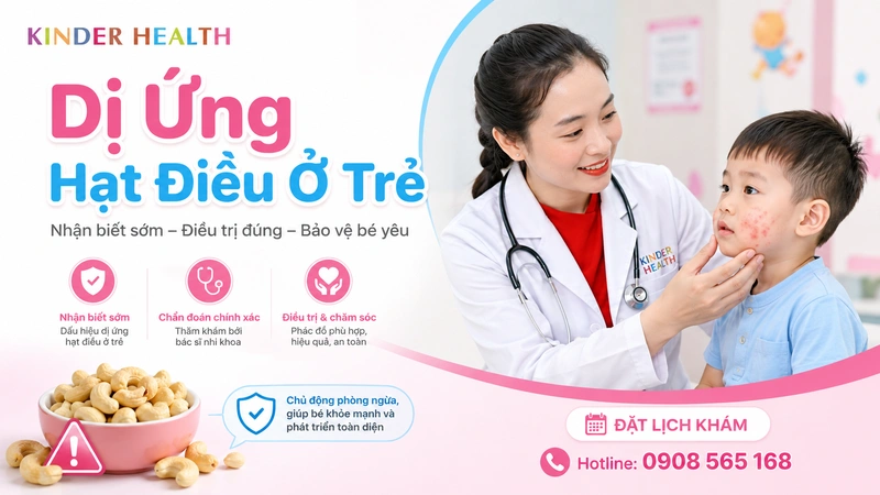 dị ứng hạt điều ở trẻ
