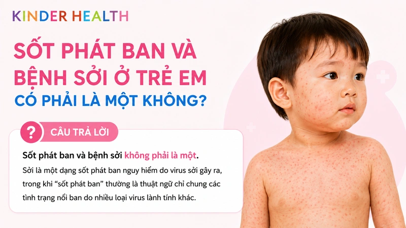 Sốt phát ban và bệnh sởi ở trẻ em có phải là một không?